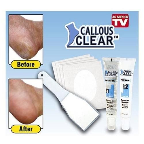 callous clear bőrkeményedést eltávolító szett callous clear bőrkeményedést eltávolító szett
