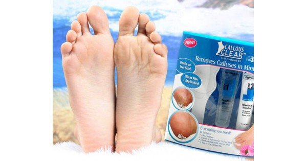 callous clear bőrkeményedést eltávolító szett callous clear bőrkeményedést eltávolító szett