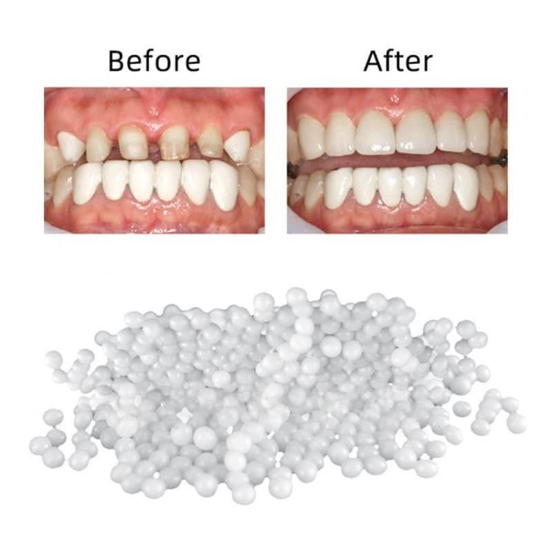 instant smile kit 30db ideiglenes fogpótló instant smile kit 30db ideiglenes fogpótló