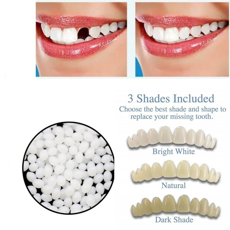 instant smile kit 30db ideiglenes fogpótló instant smile kit 30db ideiglenes fogpótló