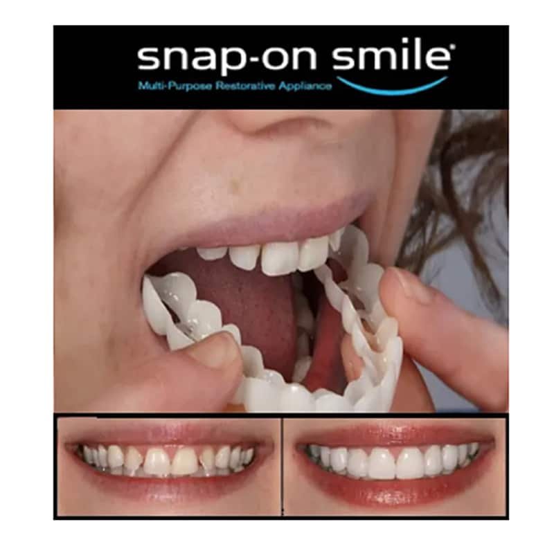 snap on smile, ideiglenes alsÓ felsŐ kozmetikai foghÍd snap on smile, ideiglenes alsÓ felsŐ kozmetikai foghÍd